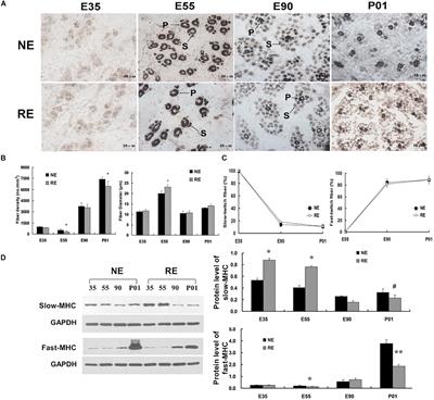 Transcriptome Characterization of Repressed Embryonic Myogenesis Due to Maternal Calorie Restriction